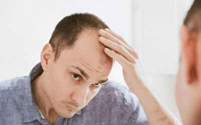 Harley Street Hair Transplant: Why It’s the Best in London